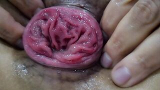 Fisting deep, sloppy anal👌, rectal prolapse - a sick plan unfold